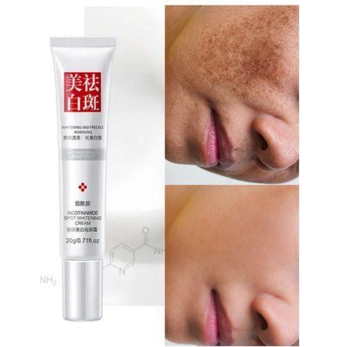 Sunburn, Dark Spots & Freckles Removal Cream Item | Buy Sunburn, Dark Spots & Freckles Removal Cream | SPOP Enterprise Global